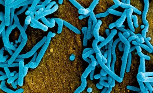 Marburg virus